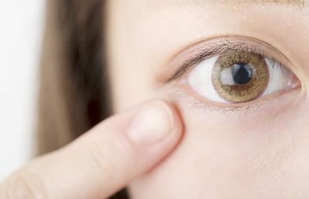 帯状疱疹が目の周囲にできた場合はご注意を（oka/stock.adobe.com）