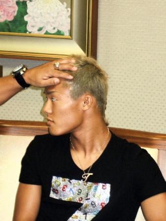 円形脱毛症になった部分を見せる亀田和毅