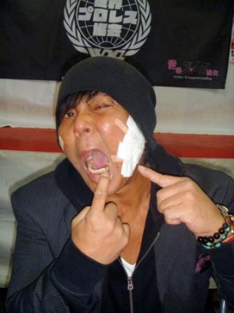 １２日の元貴闘力との乱闘であごを痛め、差し歯がダメになったと明かした大仁田厚