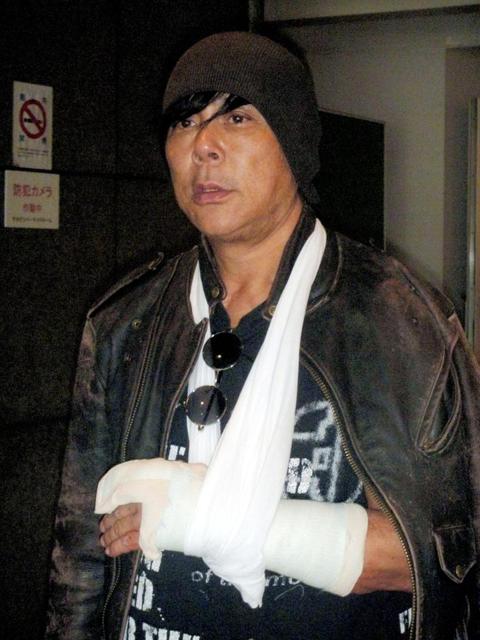 大仁田、左手人差し指骨折で全治８週間