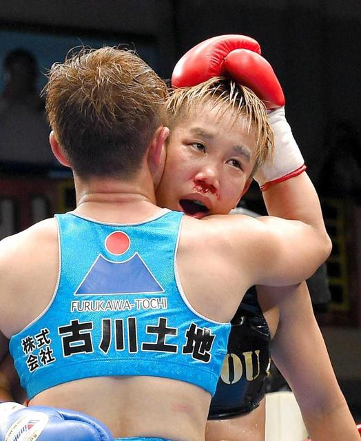 真道ゴー惨敗 左眼窩底と鼻骨骨折