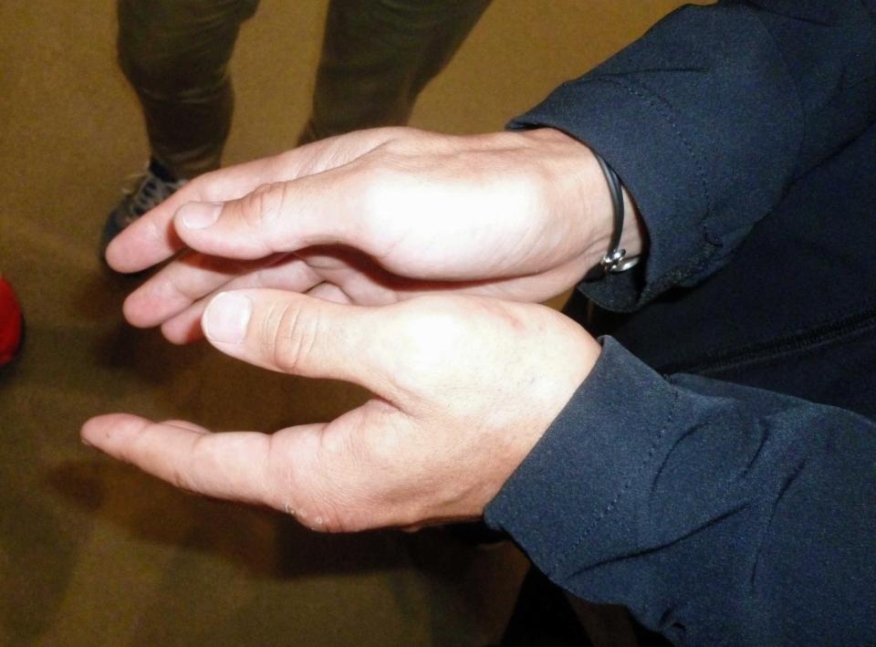 長谷川穂積 左手全治２カ月だった 世界戦１カ月半前に親指を脱臼骨折 ファイト デイリースポーツ Online