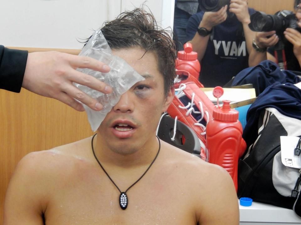 痛めた右目を氷で冷やす伊藤雅雪