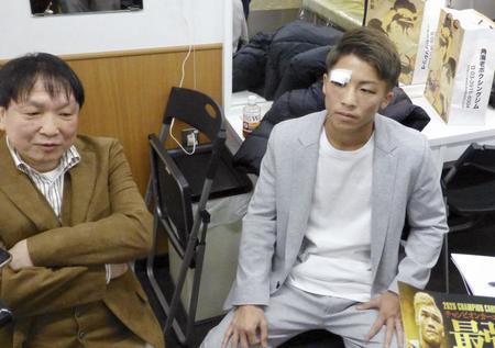 　報道陣に骨折の状態を語る井上尚弥。左は大橋秀行会長