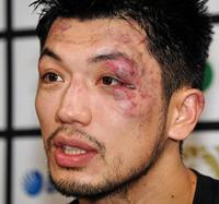 激闘を物語る顔で会見する村田諒太（撮影・棚橋慶太）