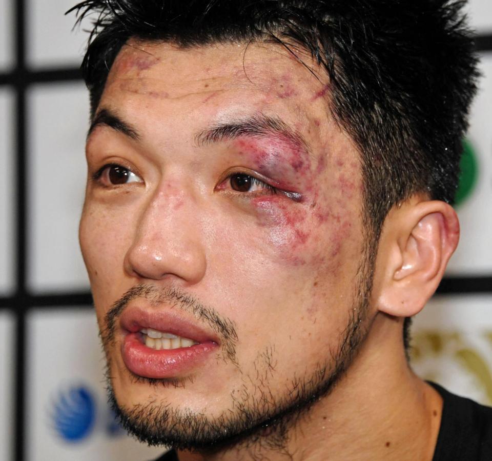 激闘を物語る顔で会見する村田諒太（撮影・棚橋慶太）