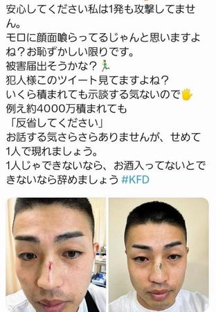 アドリブまさおのＸ（＠ａｄｌｉｂｃｈａｎｎｅｌ）から