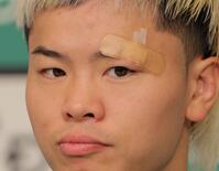 　左目の上に絆創膏を貼り会見する那須川天心（撮影・吉澤敬太）