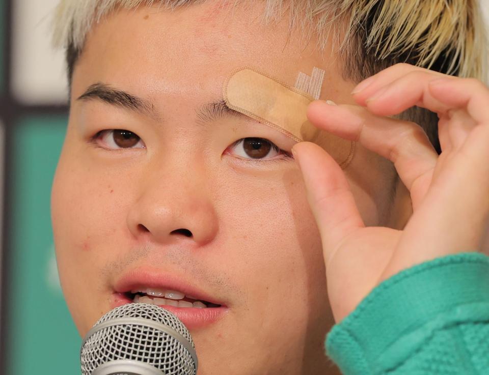 　左目の上の傷に関して話す那須川天心（撮影・吉澤敬太）