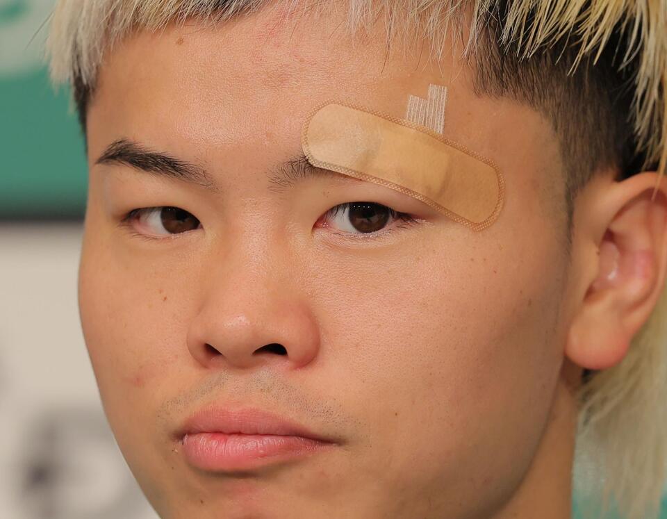 　左目の上に絆創膏を貼り会見する那須川天心（撮影・吉澤敬太）