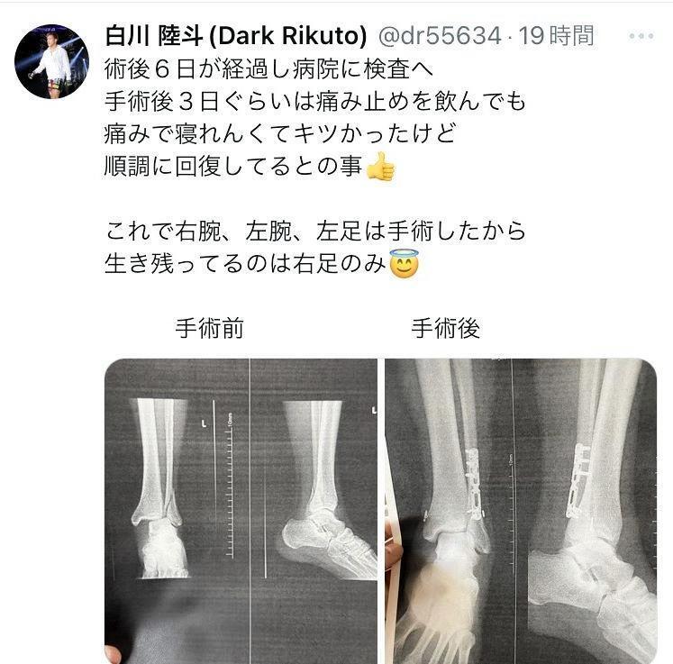 白川陸斗のＸ（＠ｄｒ５５６３４）から