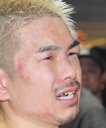 　試合後、顔を腫らし悔しさをにじませる井岡一翔（撮影・吉澤敬太）