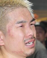 　試合後、顔を腫らし悔しさをにじませる井岡一翔（撮影・吉澤敬太）