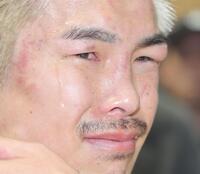 　試合後、顔を腫らし悔しさをにじませる井岡一翔（撮影・吉澤敬太）