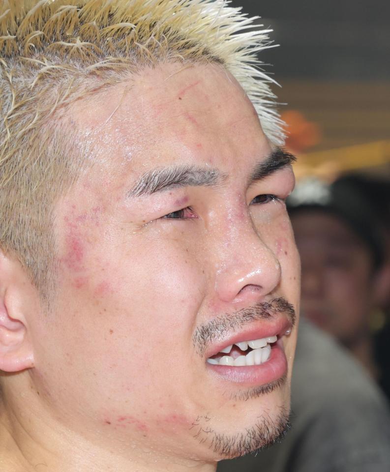 　試合後、顔を腫らし悔しさをにじませる井岡一翔（撮影・吉澤敬太）