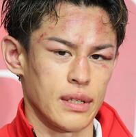 　試合後、顔を腫らして会見する力石政法（撮影・吉澤敬太）