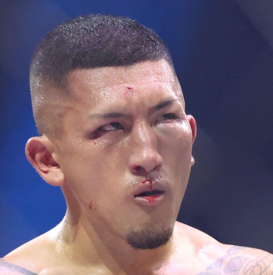 　外枦保尋斗に敗れ、顔面が腫れ上がる森＝１３日