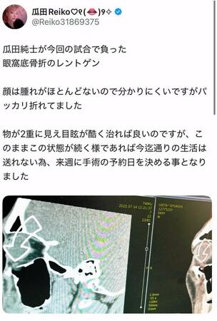 　瓜田麗子さんのＸ＠Ｒｅｉｋｏ３１８６９３７５より