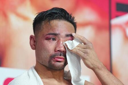 　試合後の記者会見で、引退を表明し涙を見せる比嘉大吾