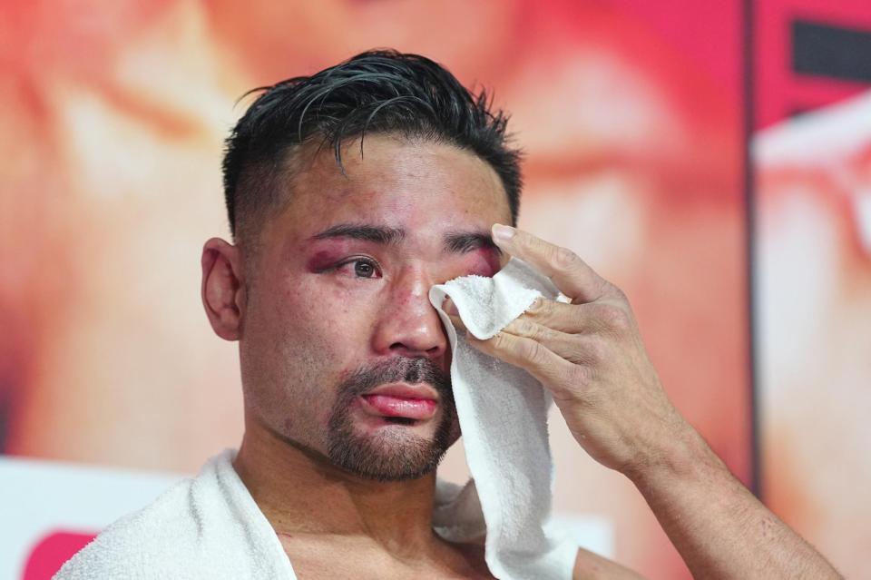 　試合後の記者会見で、引退を表明し涙を見せる比嘉大吾