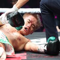 　５Ｒ、流血する高田勇仁（撮影・中田匡峻）