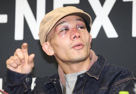 V2堤聖也、ドネアとの激闘で顔面崩壊「悲しい姿に…」鼻骨骨折&裂傷縫合手術で4時間超 会見中に鼻血&異例の薬タイムも「生き残れて安堵」