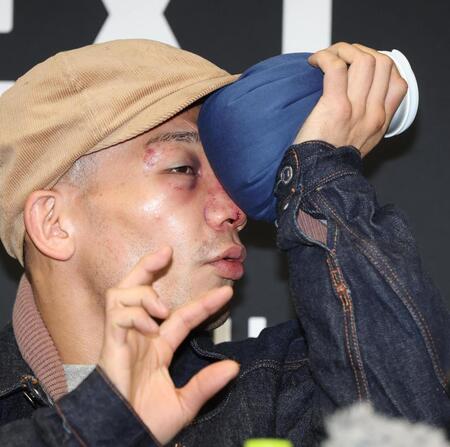 　痛みで氷のうを当てながら質問に答える堤聖也（撮影・金田祐二）