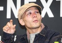 　激闘から一夜明け、痛々しい顔で会見する堤聖也（撮影・金田祐二）