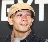 　激闘から一夜明け、なんとか笑顔を見せる堤聖也（撮影・金田祐二）