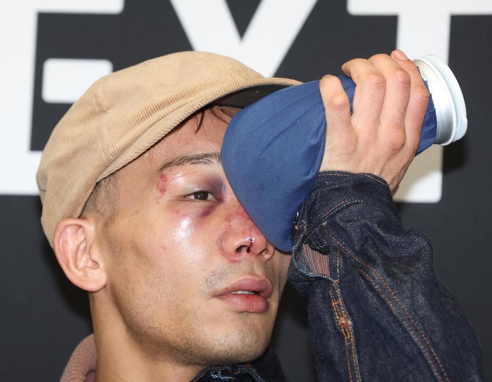 　痛みで氷のうを当てる堤聖也（撮影・金田祐二）