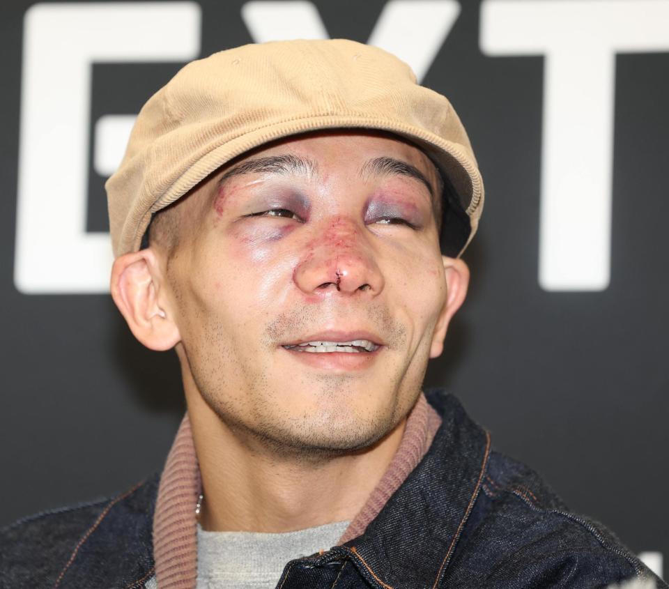 　激闘から一夜明け、なんとか笑顔を見せる堤聖也（撮影・金田祐二）