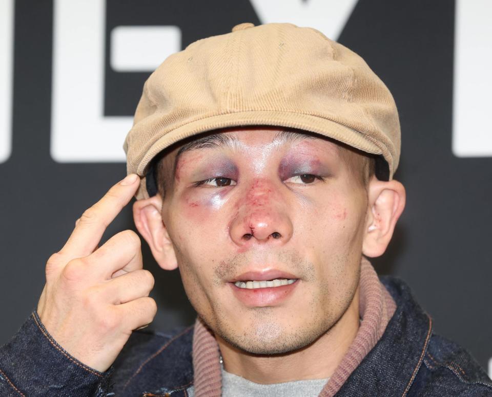 　一夜明け、痛々しい顔で会見する堤聖也（撮影・金田祐二）