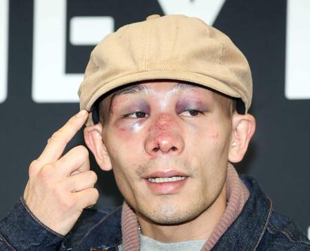 　激闘から一夜明け、痛々しい顔で会見する堤聖也（撮影・金田祐二）　