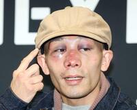 　激闘から一夜明け、痛々しい顔で会見する堤聖也（撮影・金田祐二）　