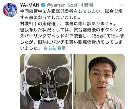 　ＹＡ-ＭＡＮのＸ（＠ｙａｍａｎ＿ｋｏｓｆ）より