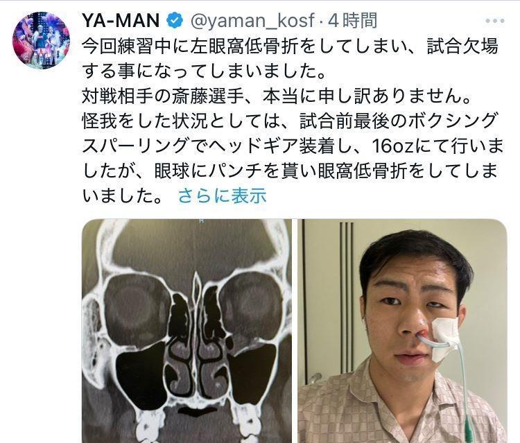 　ＹＡ-ＭＡＮのＸ（＠ｙａｍａｎ＿ｋｏｓｆ）より