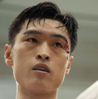 ２Ｒ、流血する西田凌佑（撮影・中田匡峻）