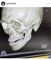 桜庭大世のインスタグラム＠ｔａｉｓｅｉ３９３９より