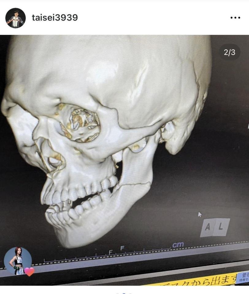 桜庭大世のインスタグラム＠ｔａｉｓｅｉ３９３９より