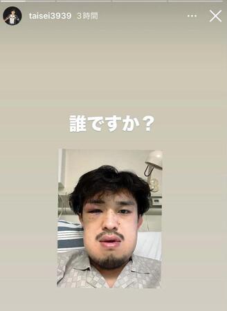 桜庭大世のインスタグラム＠ｔａｉｓｅｉ３９３９より
