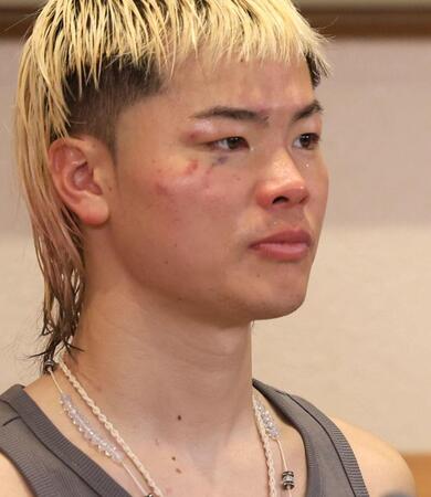 腫れた顔で会見する那須川天心（撮影・佐々木彰尚）