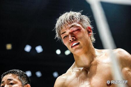 ２回ＴＫＯ負けを喫した細川一颯　©ＲＩＺＩＮ　ＦＦ