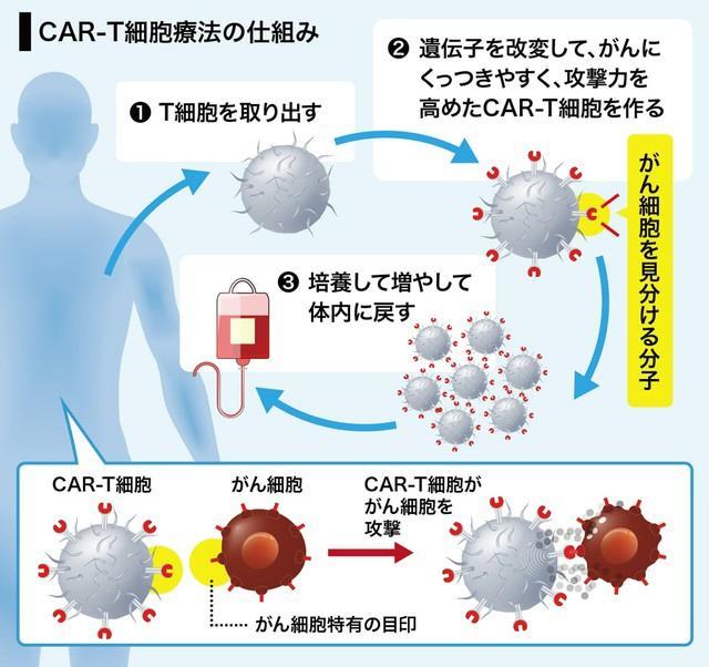 白血病治療薬、3349万円のキムリアの実力はいかほど？　再発の報告も…改善の余地あり