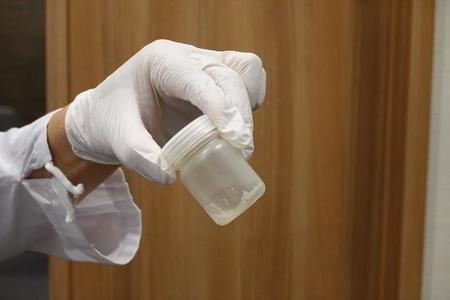 唾液PCR検査に必要な唾液は約3ml。意外と多いので、直前に激しい運動をしていると採取に手間取ることも。うがいは厳禁とも＝神戸市中央区、神戸国際医療連携クリニック（撮影・西村吉晃）