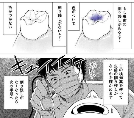 歯科治療って何をされてるかわからないまま受けてることが多いと思います（小西真冬さん提供）