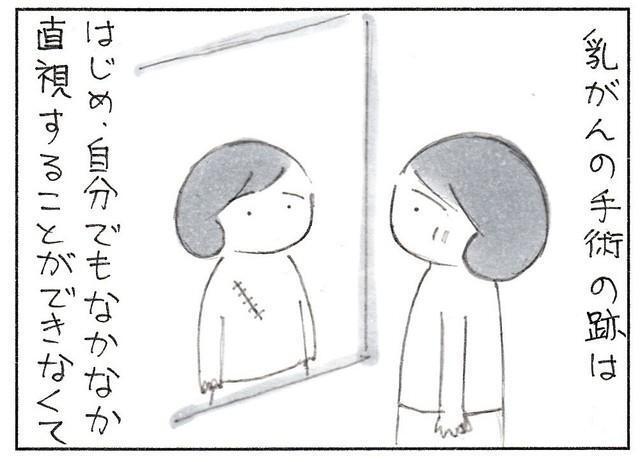 自分でも直視できなかった手術跡（なりたりえさん提供）