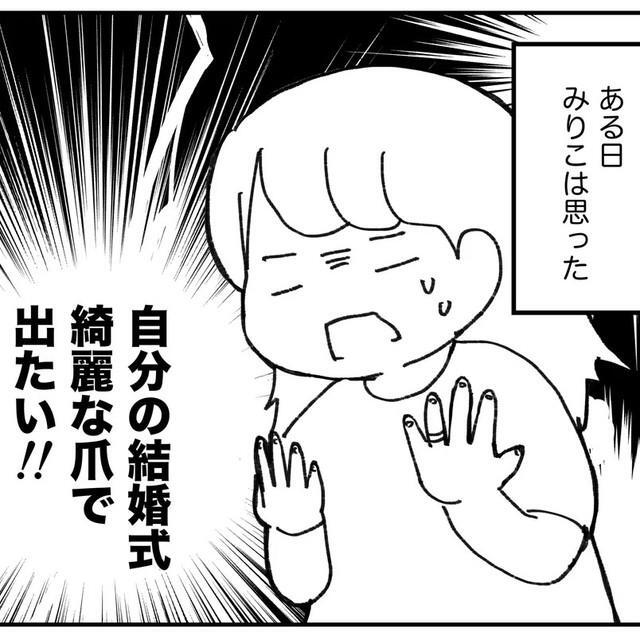 深爪で悩んでたけれど結婚式は綺麗な爪で出たい！（みりこさん提供）