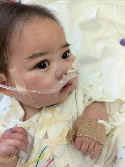 小さな体で手術を頑張った千香ちゃん