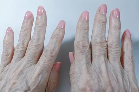 「おばあちゃん、90歳の誕生日おめでとう」認知症の祖母に桜色のネイルアートをプレゼント 「あんた、温かい手やねぇ」孫も一生の思い出に