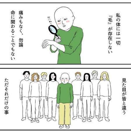 髪がない私は“かわいそう”なの？…治らない自分を責め、反発した日々　3歳で脱毛症を発症した女性が、母の愛情に気づくまで【漫画】
